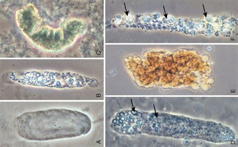 They form in the distal convoluted tubule and collecting ducts of nephrons, then dislodge and pass into the urine, where they can be detected by microscopy. Medical Laboratory and Biomedical Science: Urinary casts
