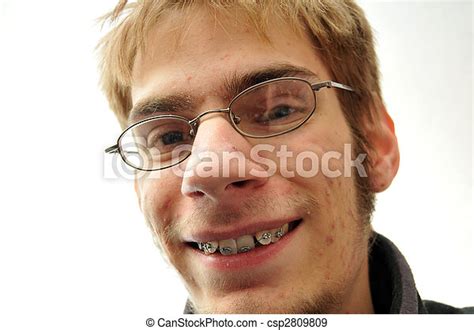 Ugly Nerd Smiling Young Man Trying To Smile With Braces And Glasses