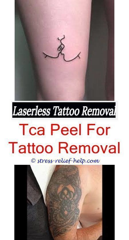 Botox, dermal fillers, microdermbarsion, chemical peels, and laser hair removal and skin rejuvenation. cosmetic tattoo removal how does tattoo removal work yahoo - how much does it cost to remove ...