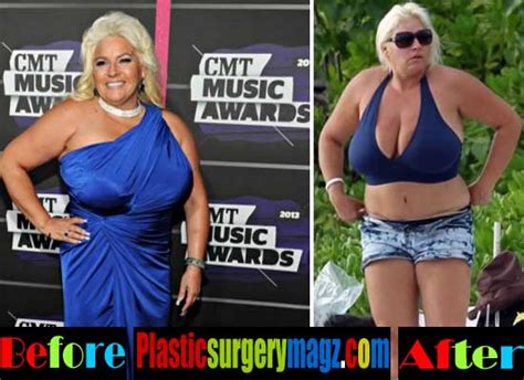 beth chapman plastic surgery before and after pictures plastic surgery magazine
