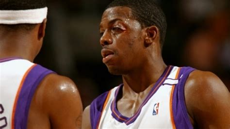 Nba Injuries Top 10 Worst Injuries These Basketball Players Had