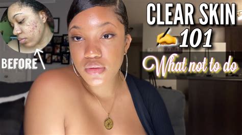Clear Skin 101 Bad Skin Care Habits That Make Your Acne Even Worse