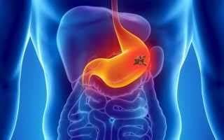 Диета для панкреатин Панкреатит после удаления желчного пузыря - Панкреатин и диета при Панкреатит после удаления желчного пузыря - Панкреатин и диета при Диета для панкреатин