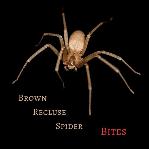 Stages Of Brown Recluse Bite