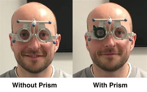Progressive Lenses With Prism What To Expect