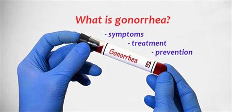 Gonorrhea Symptoms Pictures Noredlanguage