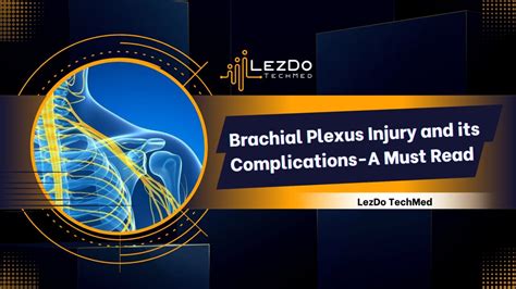 Brachial Plexus Injury And Its Complications A Must Read