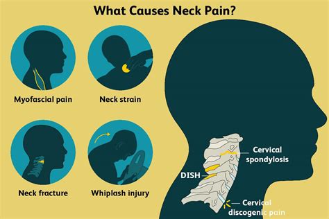 Common Causes For Neck Pain Our Medical Blog