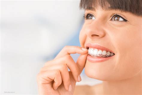 straighten your smile seamlessly with invisalign® clear aligner therapy shirck orthodontics