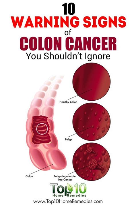 Here in this article, we are going to know the signs and symptoms of this colon cancer and how to overcome this problem with an early treatment to get faster recovery. 33 best Flat Designs images on Pinterest | Apartment ...