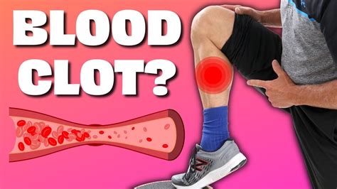 Is Your Calf Pain A Blood Clot Do Homans Test And Find Out Youtube
