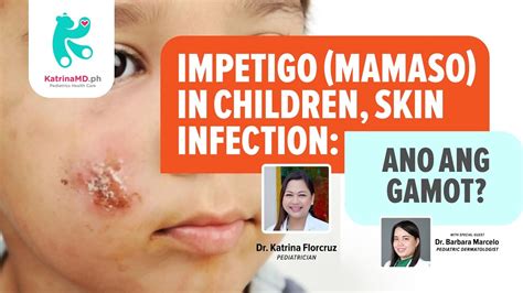 Impetigo Mamaso In Children Skin Infection Ano Ang Gamot Youtube