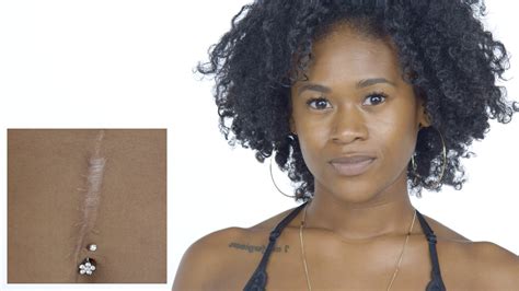 Watch What One Brave Woman Would Say To The Person Who Shot Her Dispelling Beauty Myths Allure