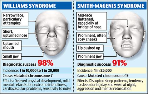 Facial Scans Could Reveal Genetic Disorders Daily Mail Online