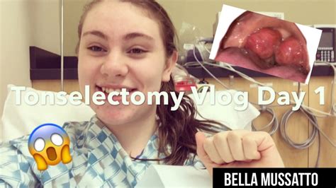 Removing My Tonsils And Recovery Vlog Youtube