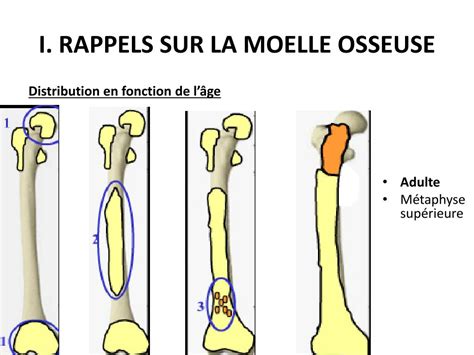 Ppt Irm De La Moelle Osseuse Aspect Normal Variantes Et Pathologie