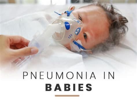 Pneumonia In Babies Causes Symptoms Diagnosis And Treatment