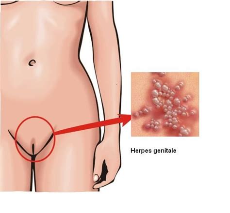 So how do they measure their progress? Pin on Health-Fitness