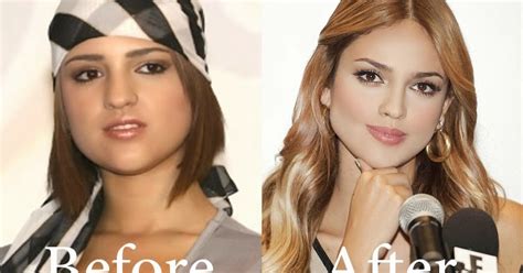 Celebrity Before After Plastic Surgery Eiza Gonzalez Before After