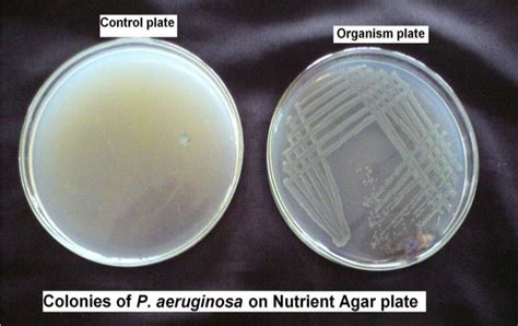 Colonies Of Pseudomonas Aeruginosa On Nutrient Agar Plate Download