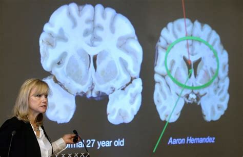 Kids And Concussions The Latest Science On Risks And Long Term