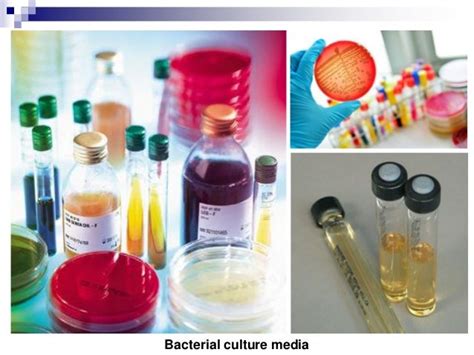 Microbiology Urine Culture