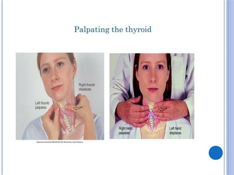 Ppt Endocrine Disorders Nursing The Client With Thyroid And Parathyroid Dysfunction
