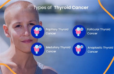 Thyroid Cancer Everything You Need To Know Actc