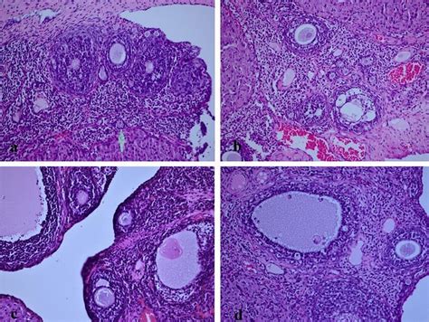 A Primordial Primary And Secondary Follicles In Group 1 Normal