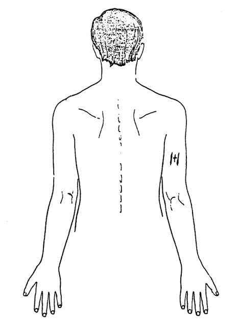 Location Of Triceps Skinfold