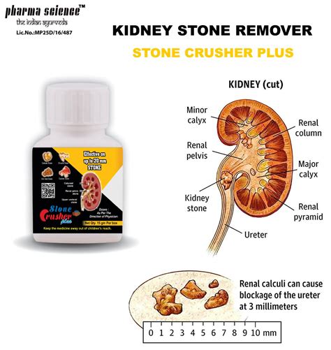 Pharmascience Powder Kidney Stone Pain Relief Packaging Size 15 Gm