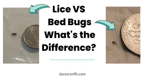 Lice Vs Flea Comparison Friendly Guide To Pest Differences