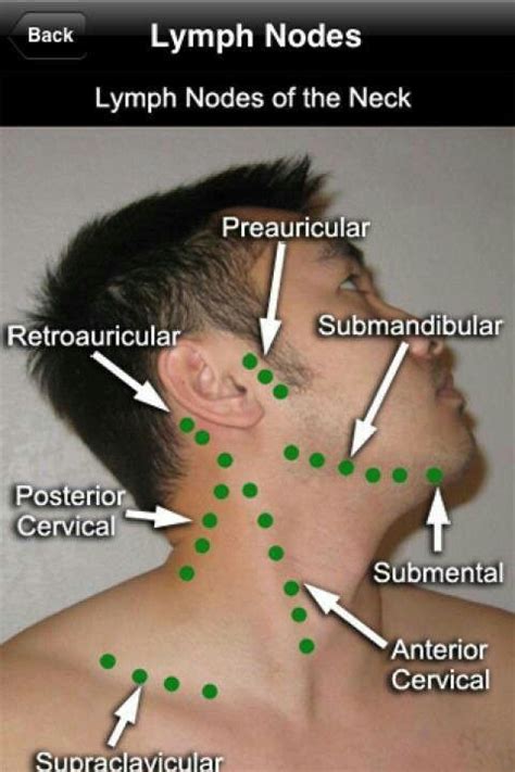 What Causes Mandibular Lymph Nodes To Swell Types Of
