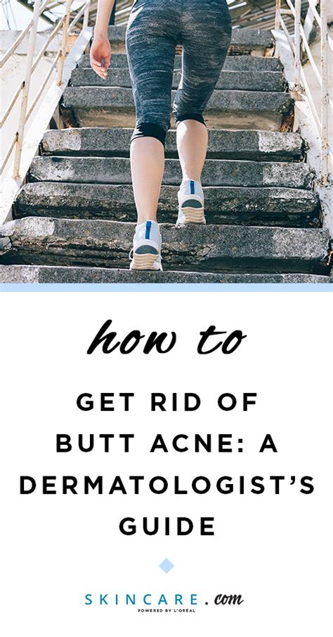 We Know That Butt Acne Can Be Uncomfortable And Embarrassing So Were