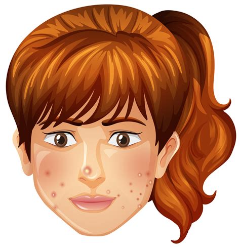 A Girl with Pimples Problem 298104 Vector Art at Vecteezy