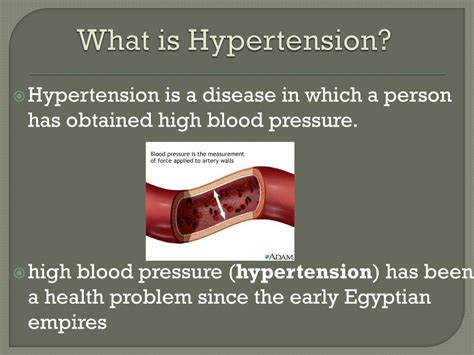 Ppt Hypertension Powerpoint Presentation Free Download Id5073593