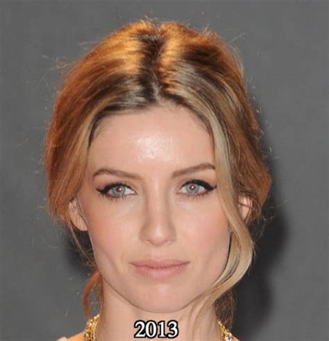 Annabelle Wallis Nose Job Plastic Surgery Before And After Photos