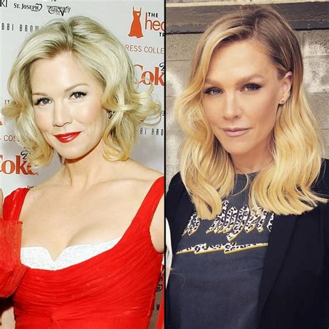 Celebrity Plastic Surgeries Before And After Images Page Of