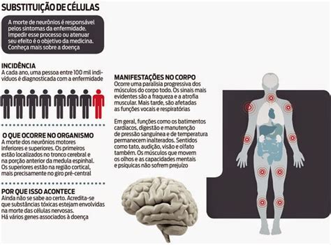 Esclerosis lateral amiotrófica (ela) parálisis bulbar progresiva atrofia muscular progresiva esclerosis lateral primaria y parálisis la mayoría de los pacientes con esclerosis lateral amiotrófica se presentan con síntomas asimétricos al azar, que consisten en calambres, debilidad y. Meme - Desafio do Balde de Gelo (Ice Bucket Challenge) | Sequelanet