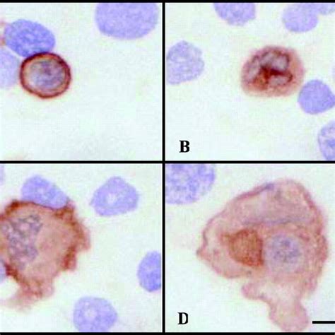 อัลบั้ม 102 ภาพพื้นหลัง Leukocytes ในปัสสาวะ ใหม่ที่สุด