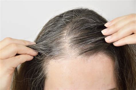 New Study Finds Grey Hair Could Be Reversible With Less Stress