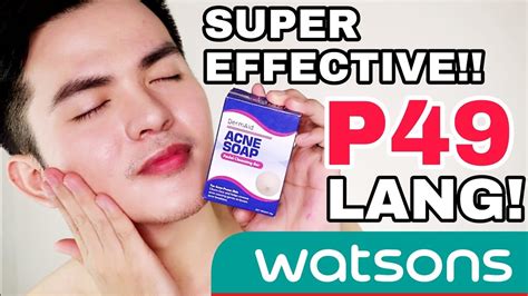 It claims to effectively treat acne by removing the dirt and impurities from the skin. DermAid ACNE SOAP sa WATSONS Super Effective for PIMPLES ...