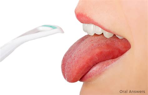 cleaning your tongue can get rid of bad breath oral answers