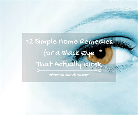 12 Simple Home Remedies For A Black Eye