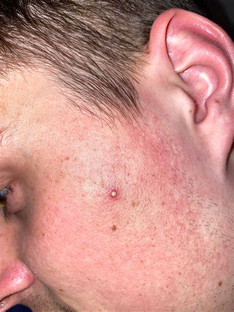progress: he let me pop AND get a photo for the first time. Notice the