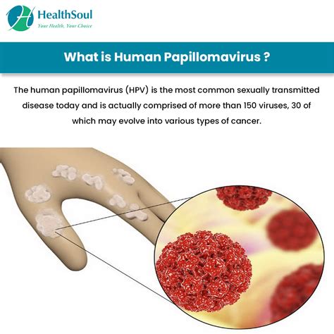 Human Papillomavirus Symptoms And Treatment Healthsoul