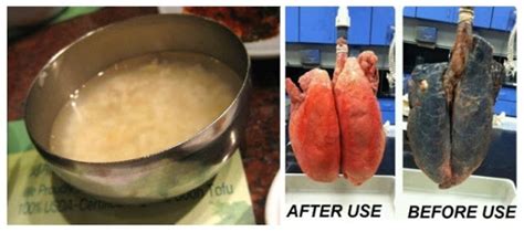this recipe will easily clear your lungs in 3 days even if you smoke more than 5 years