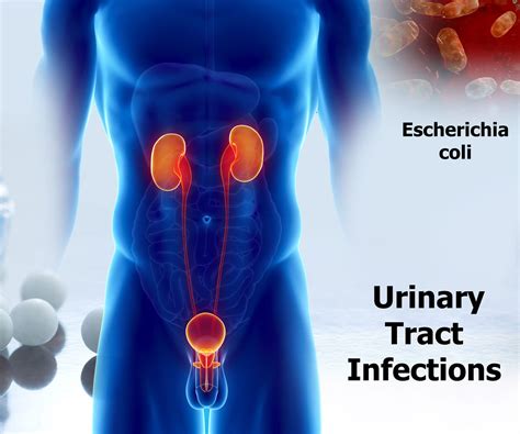 Urinary Tract Infection Treatment Market Fmi