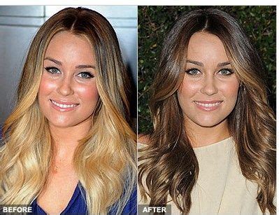 The top 25 ideas about hairstyles for receding hairline female.women hairstyle is something that can vary in many different methods. blonde to brown (With images) | Hair makeover