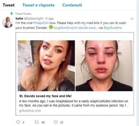 Pubblicato il 9 novembre 2015 alle ore 11:47. Si mette il mascara: volto devastato per colpa del ...